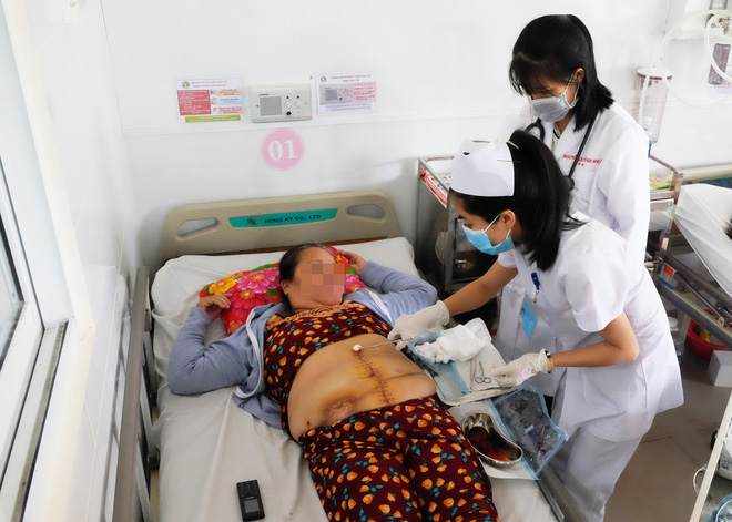 Mất con trong bụng, một phụ nữ phải gắn hậu môn nhân tạo suốt 27 năm mà không biết bị cắt gần hết ruột già