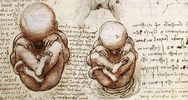 Người phụ nữ mang bầu suốt 46 năm không chịu đẻ, bác sĩ sốc nặng khi lấy bào thai ra