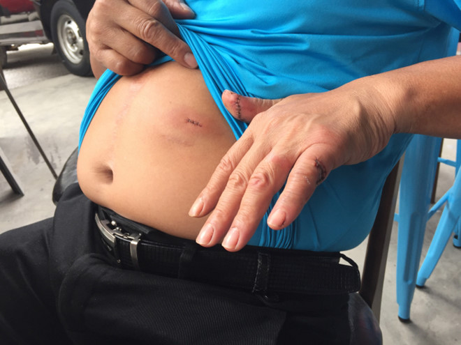 Quản lý quán bar bị đâm trong đêm quay số trúng thưởng