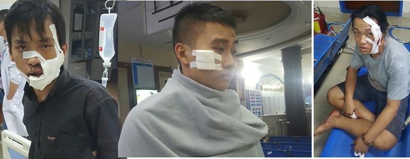 Chém nhau kinh hoàng trên phố, 5 người nhập viện