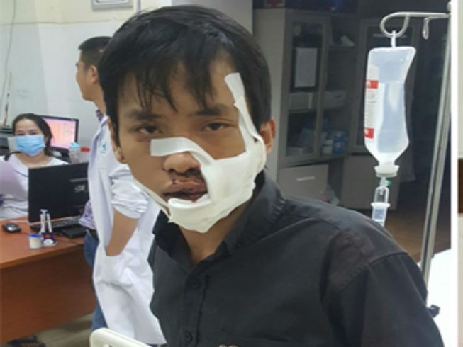 Chém nhau kinh hoàng trên phố, 5 người nhập viện Chém nhau kinh hoàng trên phố, 5 người nhập viện