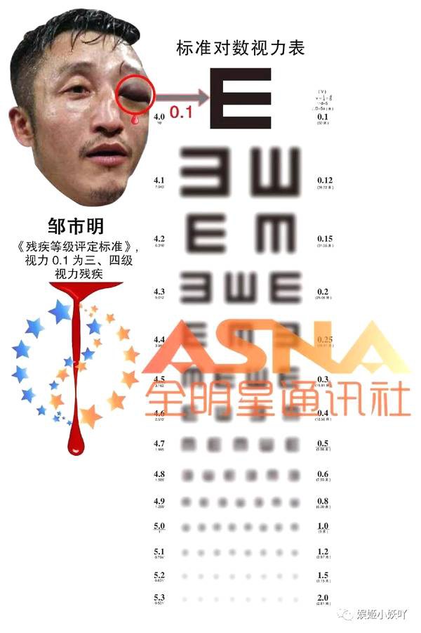 Sao phim Công Thủ Đạo đột ngột bị mù mắt: Do công ty chèn ép hay tự chuốc lấy?