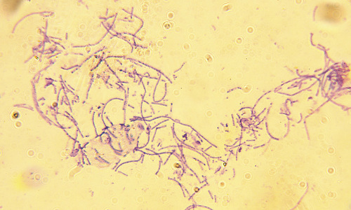 Hiểm họa từ bệnh than trong chiến tranh sinh học