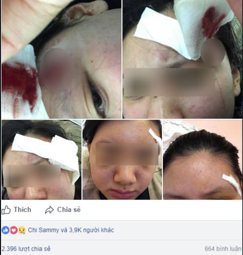 Hà Nội: Người vợ xinh đẹp tố bị chồng đánh rách đầu, mang bầu cũng hành hung không tha