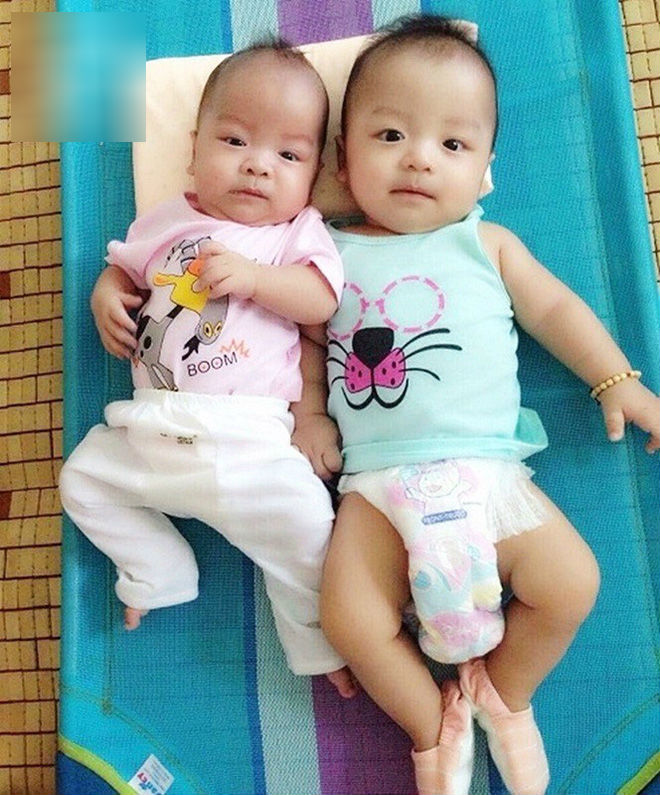 Bé sinh non bị xơ phổi rất nặng, cha vượt nghìn cây số đưa con đi ghép tế bào gốc và điều kỳ diệu xuất hiện