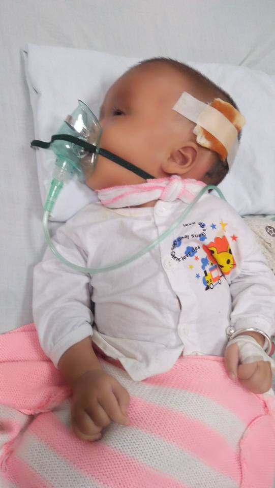 Người mẹ 18 tuổi và phép màu cứu con bị não úng thủy