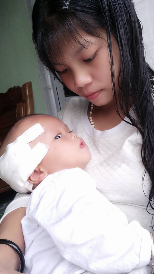 Người mẹ 18 tuổi và phép màu cứu con bị não úng thủy