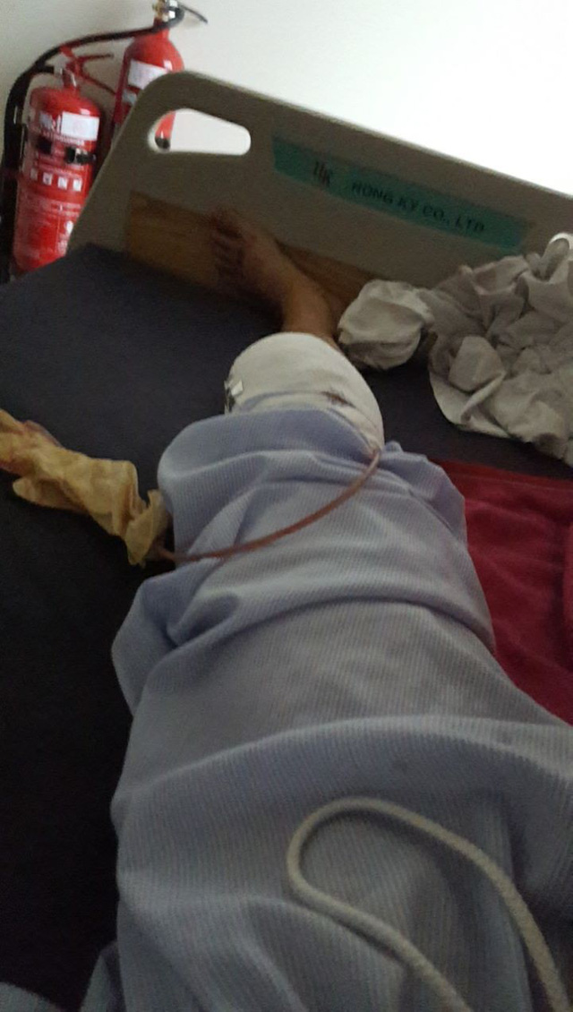 Bị tai nạn, phượt thủ khuyên đi để trở về an toàn và lành lặn