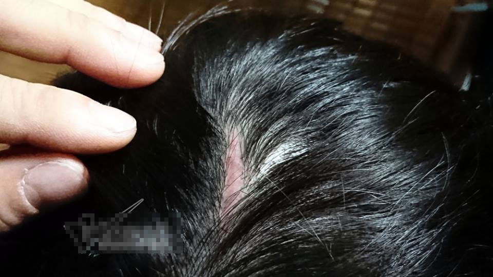 Bé trai bị bố và mẹ kế đánh rạn sọ não xin tha cho bố Bé trai bị bố và mẹ kế đánh rạn sọ não xin tha cho bố