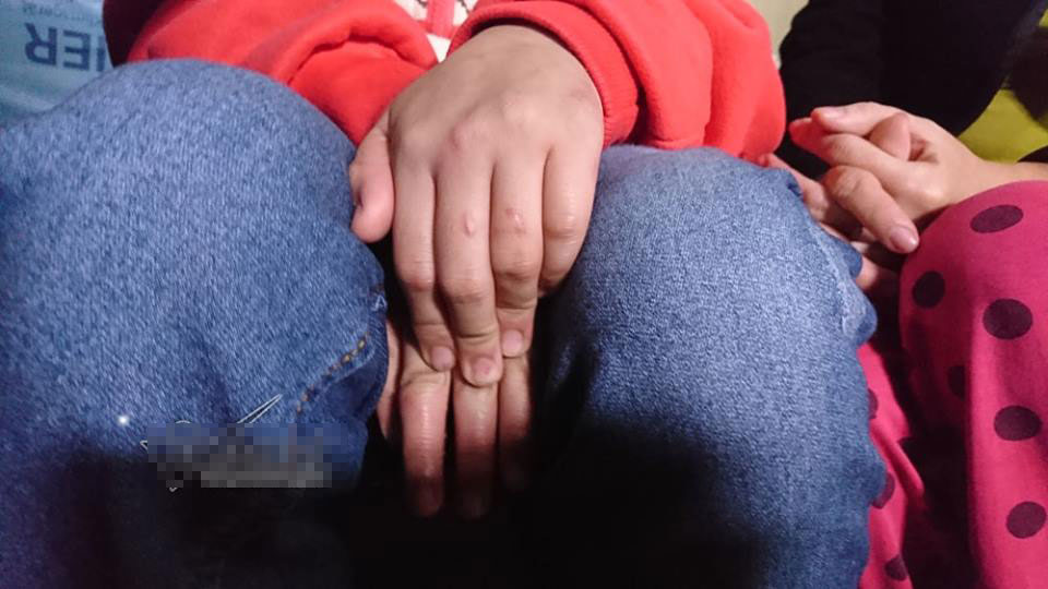 Bé trai bị bố và mẹ kế đánh rạn sọ não xin tha cho bố Bé trai bị bố và mẹ kế đánh rạn sọ não xin tha cho bố