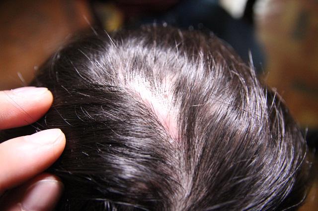 Bé 10 tuổi bị bạo hành: Đến bữa bố và cô bê mâm vào phòng, còn cháu ăn ở ngoài