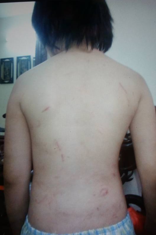 Vụ bé trai 10 tuổi bị bạo hành dã man: Mẹ kế thừa nhận bạo hành con chồng vì cháu ăn vụng thịt bò Vụ bé trai 10 tuổi bị bạo hành dã man: Mẹ kế thừa nhận bạo hành con chồng vì cháu ăn vụng thịt bò