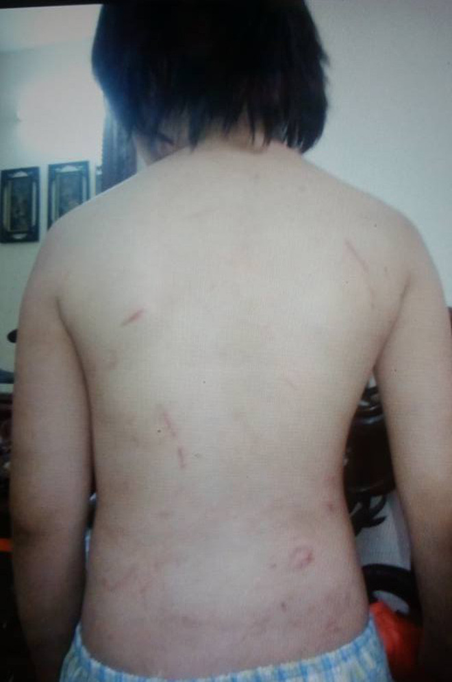 Mẹ kế khai nhận toàn bộ hành vi đánh đập, bạo hành cháu bé 10 tuổi ở Hà Nội Mẹ kế khai nhận toàn bộ hành vi đánh đập, bạo hành cháu bé 10 tuổi ở Hà Nội