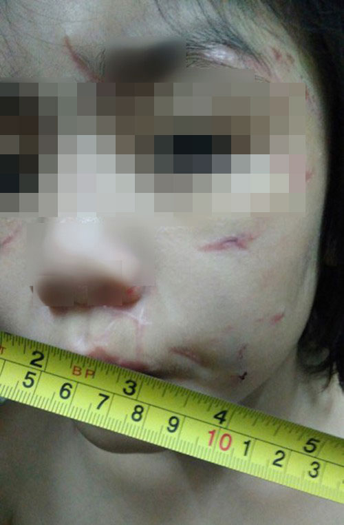 Bác sĩ tâm lý mổ xẻ vụ bố, mẹ kế bạo hành bé trai 10 tuổi