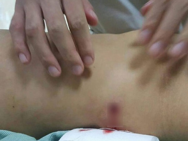 Điều tra vụ bắt đánh bạc một người bị trúng đạn