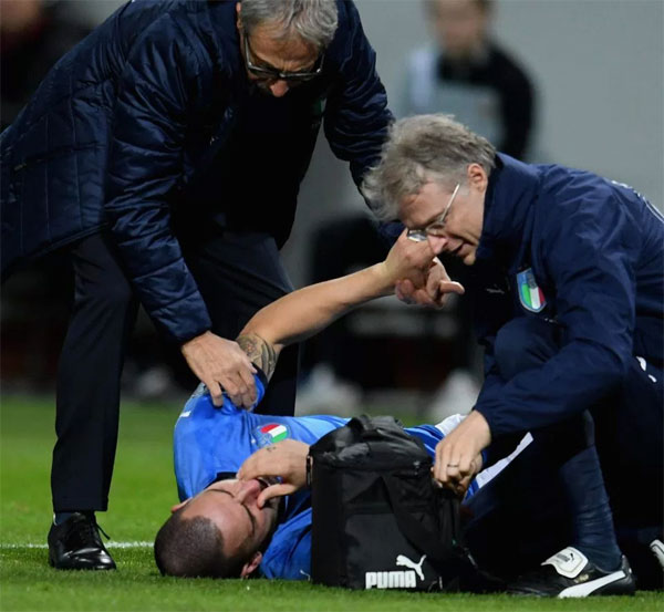 Hậu vệ Italy chơi trọn 90 phút dù mũi bị vỡ