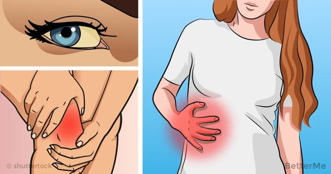 6 dấu hiệu cảnh báo gan của bạn có thể đang... bị hỏng