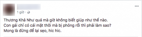 Sau 1 ngày im lặng, Khả Như lên tiếng trước sự cố bị bỏng nặng khi tập kịch