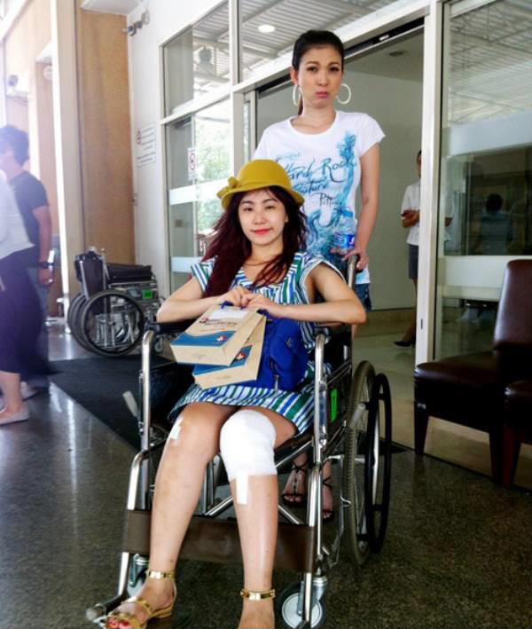 Sao Việt bị bỏng lửa đến mức không dám soi gương