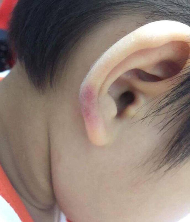 Hà Nội: Clip quay lén bắt quả tang mẹ kế đánh đập dã man con chồng gây phẫn nộ dư luận Hà Nội: Clip quay lén bắt quả tang mẹ kế đánh đập dã man con chồng gây phẫn nộ dư luận