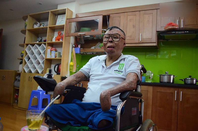 Chiến sĩ duy nhất sống sót sau vụ rơi trực thăng Hòa Lạc nghẹn ngào với đôi tay giả: Tôi vui sướng, hạnh phúc đến quên cả ăn uống