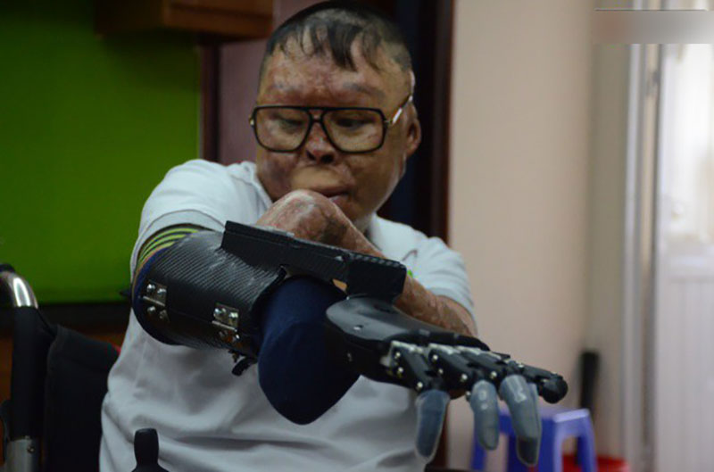 Chiến sĩ duy nhất sống sót sau vụ rơi trực thăng Hòa Lạc nghẹn ngào với đôi tay giả: Tôi vui sướng, hạnh phúc đến quên cả ăn uống