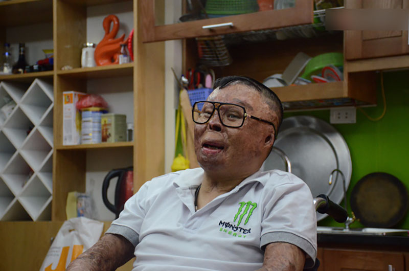 Chiến sĩ duy nhất sống sót sau vụ rơi trực thăng Hòa Lạc nghẹn ngào với đôi tay giả: Tôi vui sướng, hạnh phúc đến quên cả ăn uống