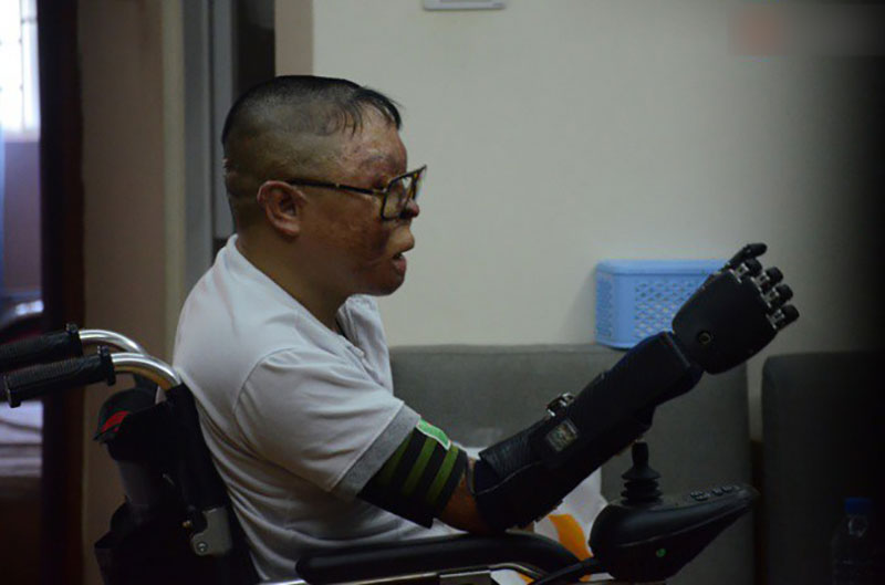 Chiến sĩ duy nhất sống sót sau vụ rơi trực thăng Hòa Lạc nghẹn ngào với đôi tay giả: Tôi vui sướng, hạnh phúc đến quên cả ăn uống Chiến sĩ duy nhất sống sót sau vụ rơi trực thăng Hòa Lạc nghẹn ngào với đôi tay giả: Tôi vui sướng, hạnh phúc đến quên cả ăn uống