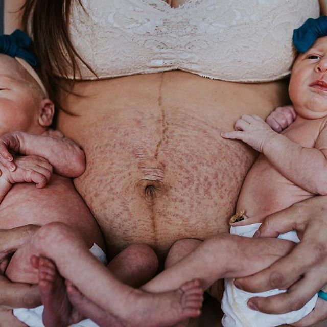 Con trai lớn hỏi Bụng mẹ bị làm sao vậy và đây là câu trả lời của người mẹ