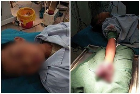 Từ cái chết của nữ sinh lớp 9 bị điện giật: Những tai nạn thương tâm do sạc điện thoại và cảnh báo từ chuyên gia