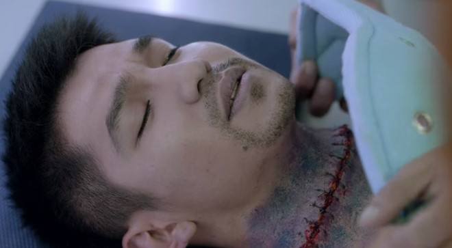 Lôi Báo của Victor Vũ hé lộ ca phẫu thuật đổi đầu ấn tượng