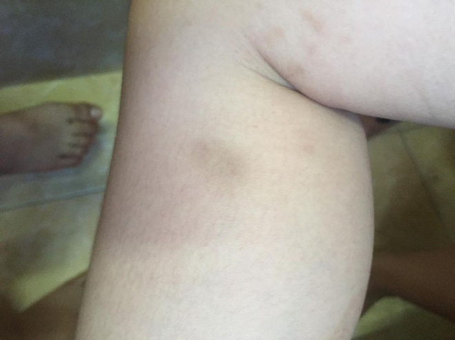 Vụ mẹ kế bạo hành con của chồng: Quay cảnh đánh con tôi đau đớn lắm nhưng cần phải có bằng chứng