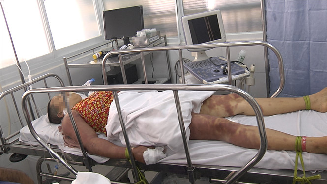 Hai chị em bị thầy trừ tà đánh bầm dập, 1 người nguy kịch