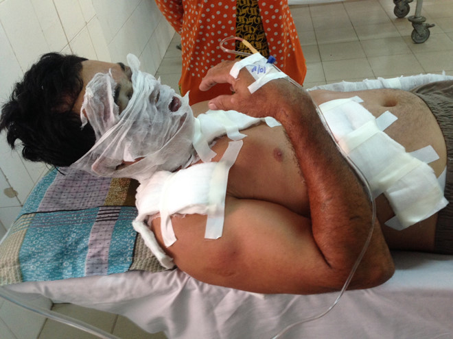 Lật lại hồ sơ vụ chủ hãng nước đá ở miền Tây bị tạt axít