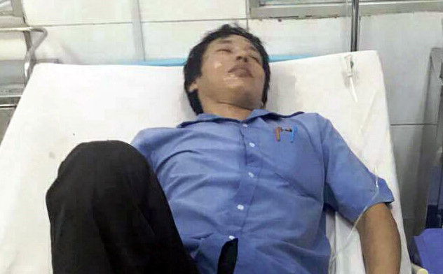 Hệ thống điện phát nổ, nhiều công nhân bị thương