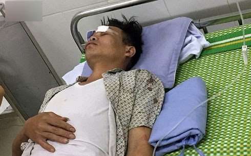 Nạn nhân kể lại giây phút kinh hoàng vụ tai nạn xe khách ở Sóc Sơn