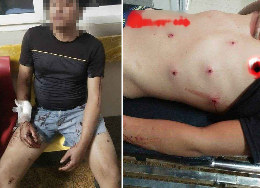 Bị truy đuổi, cẩu tặc rút súng bắn 2 người dân nhập viện