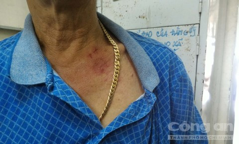 Hai tên cướp sa lưới vì giật dây chuyền vàng không đứt