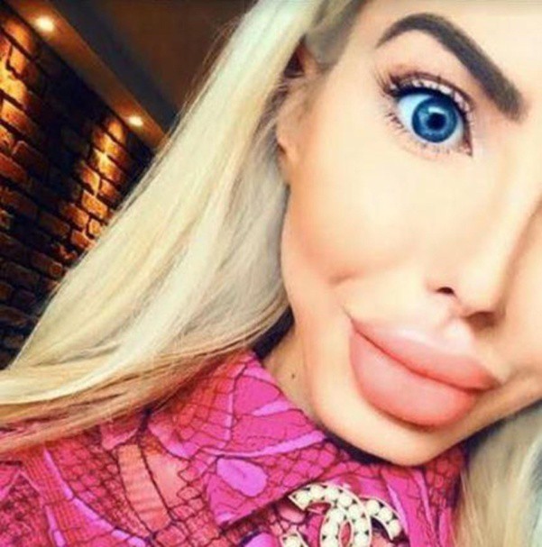 Nữ kiến trúc sư 25 tuổi chi gần 900 triệu để lột xác thành... thảm họa Barbie