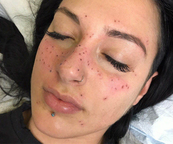 Không chỉ là xăm tàn nhang, các cô gái giờ còn phát cuồng với trào lưu xăm chòm sao lên mặt