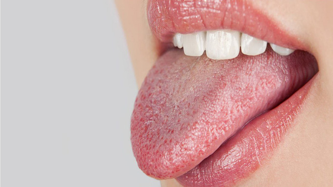 9 biện pháp khắc phục và ngăn ngừa tình trạng khô miệng bạn hoàn toàn có thể làm ở nhà 9 biện pháp khắc phục và ngăn ngừa tình trạng khô miệng bạn hoàn toàn có thể làm ở nhà