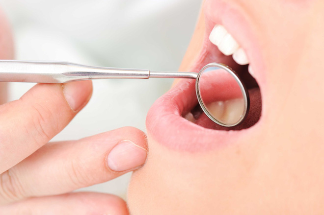 9 biện pháp khắc phục và ngăn ngừa tình trạng khô miệng bạn hoàn toàn có thể làm ở nhà 9 biện pháp khắc phục và ngăn ngừa tình trạng khô miệng bạn hoàn toàn có thể làm ở nhà