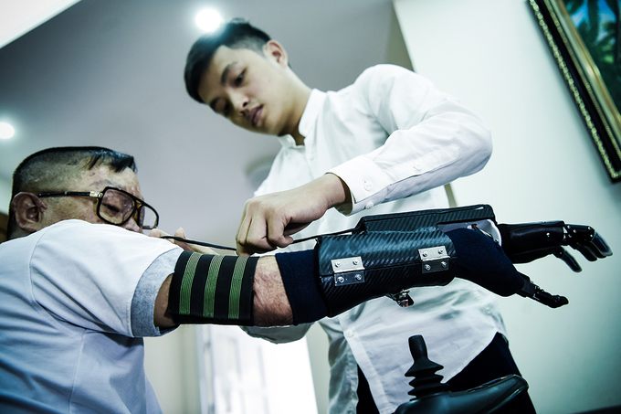 Cuộc sống sau 24 lần phẫu thuật của người lính vụ máy bay rơi