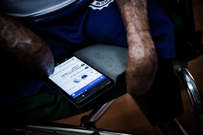 Cuộc sống sau 24 lần phẫu thuật của người lính vụ máy bay rơi