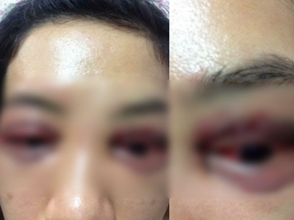 Vụ cô gái đi cắt mí mắt gây xôn xao MXH: Khi cô gái đến làm việc, chủ spa hỏi sao lại bêu xấu hình ảnh spa