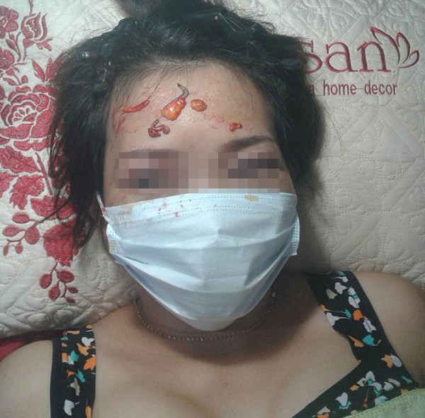 Vụ cắt mí mắt gây bão mạng: Quảng cáo rất kêu nhưng cơ sở chỉ là tiệm cắt tóc, gội đầu