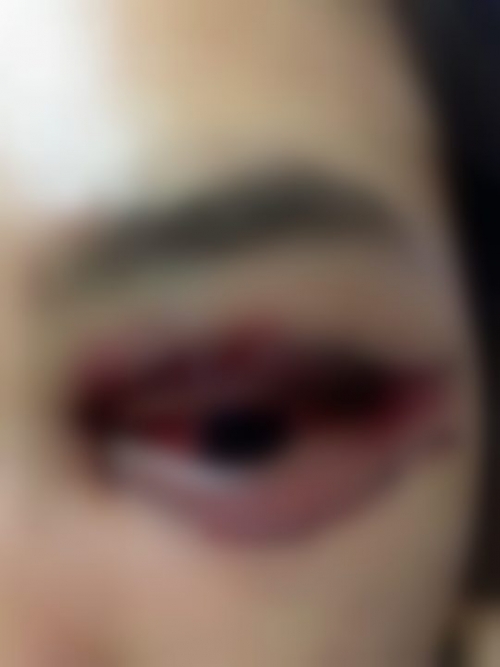 Chủ tiệm đã đóng cửa Spa, tháo biển hiệu sau vụ khách nữ bị hỏng mí mắt