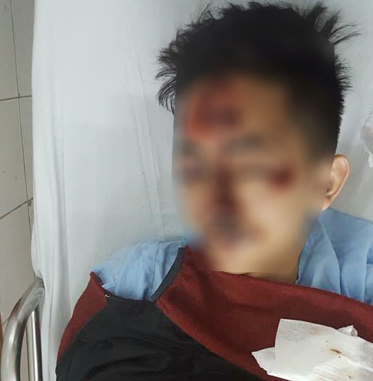 Truy tìm ôtô tông 2 nam sinh chấn thương sọ não rồi bỏ trốn