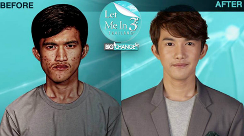 Con trai đẹp như tài tử sau thẩm mỹ khiến mẹ không thể nhận ra