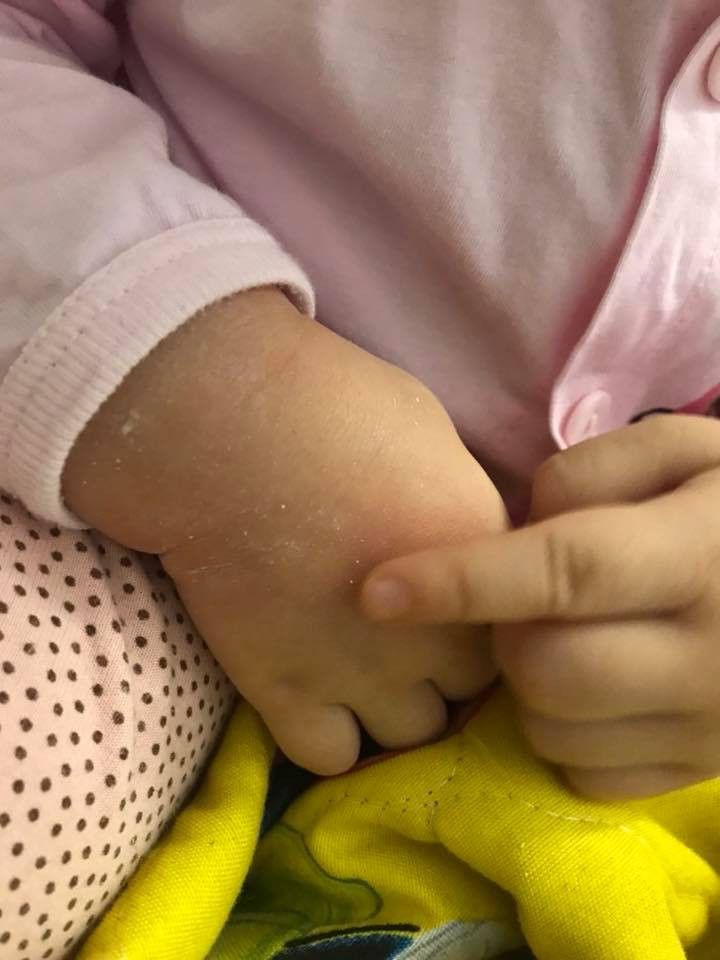 Hồng Quế tự trách móc bản thân vì một phút lơ là khiến con bị bỏng